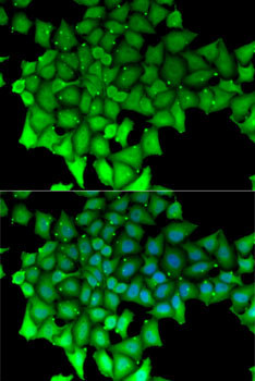 HCE Antibody in Immunocytochemistry (ICC/IF)