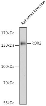 ROR2 Antibody in Western Blot (WB)