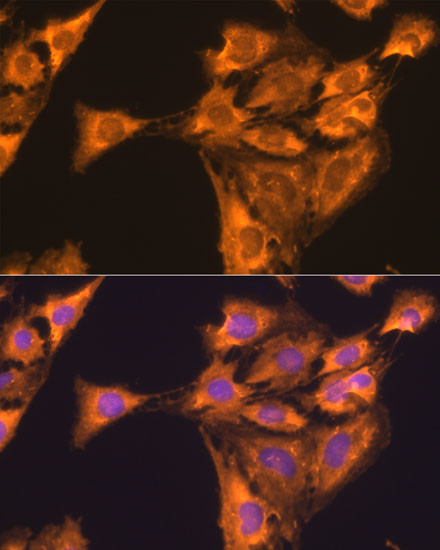 RPL23 Antibody in Immunocytochemistry (ICC/IF)