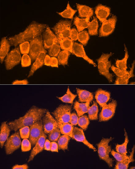 RPL23 Antibody in Immunocytochemistry (ICC/IF)