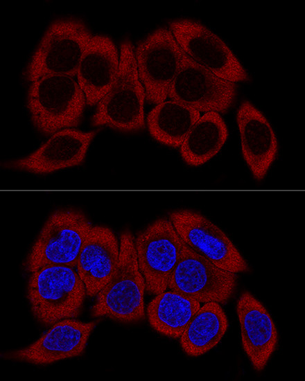 RPL23 Antibody in Immunocytochemistry (ICC/IF)