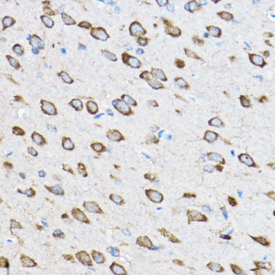 RPL23 Antibody in Immunohistochemistry (Paraffin) (IHC (P))