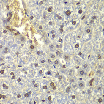 RPL5 Antibody in Immunohistochemistry (Paraffin) (IHC (P))