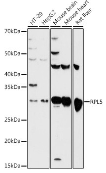 RPL5 Antibody in Western Blot (WB)