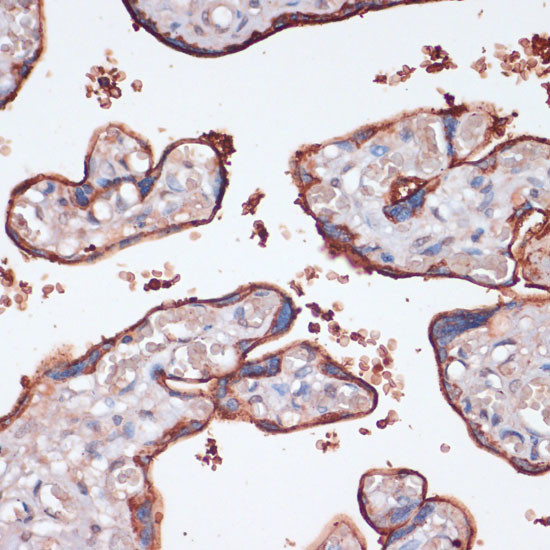 RSK3 Antibody in Immunohistochemistry (Paraffin) (IHC (P))