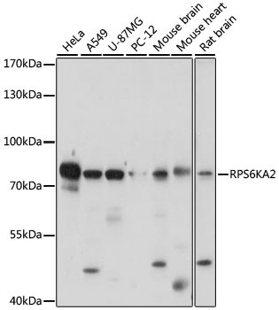 RSK3 Antibody in Western Blot (WB)