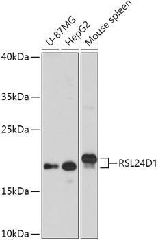 RSL24D1 Antibody in Western Blot (WB)