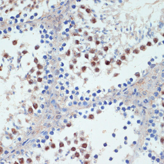 RXRG Antibody in Immunohistochemistry (Paraffin) (IHC (P))