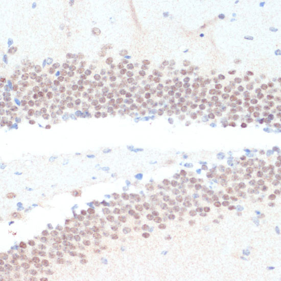 RXRG Antibody in Immunohistochemistry (Paraffin) (IHC (P))