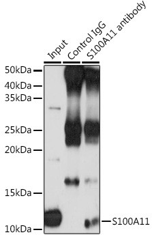 S100A11 Antibody in Immunoprecipitation (IP)