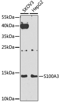 S100A3 Antibody in Western Blot (WB)