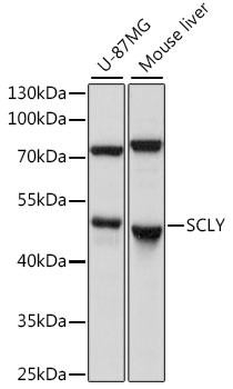 SCLY Antibody in Western Blot (WB)