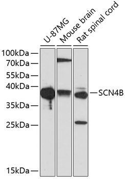 SCN4B Antibody in Western Blot (WB)