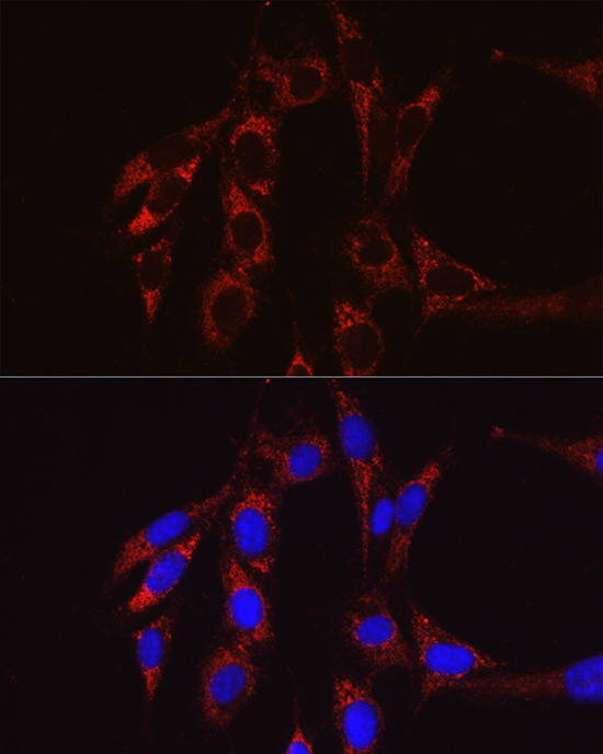 SBP2 Antibody in Immunocytochemistry (ICC/IF)