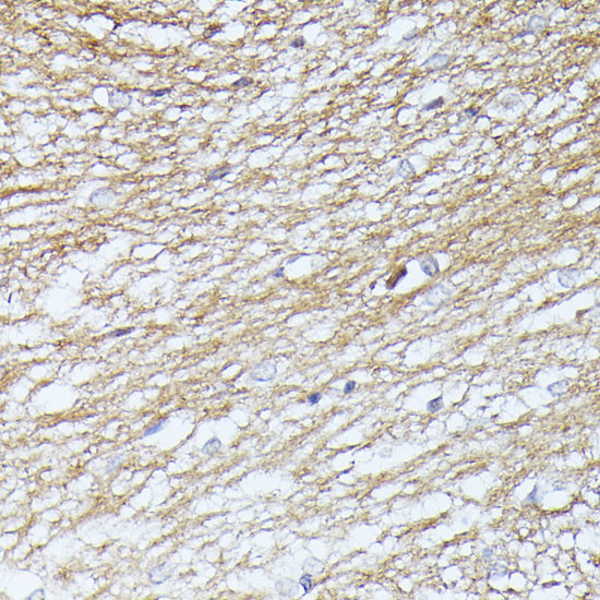 SEPT5 Antibody in Immunohistochemistry (Paraffin) (IHC (P))