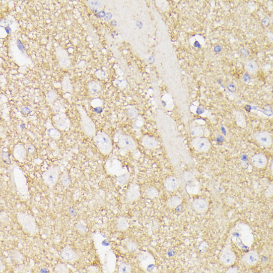 SEPT5 Antibody in Immunohistochemistry (Paraffin) (IHC (P))