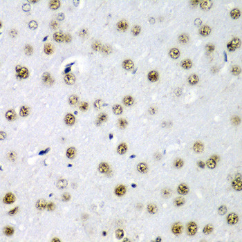 SF3B3 Antibody in Immunohistochemistry (Paraffin) (IHC (P))