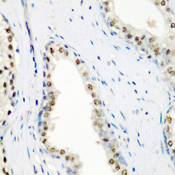 SF3B3 Antibody in Immunohistochemistry (Paraffin) (IHC (P))