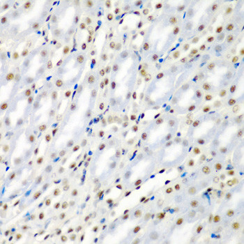 SF3B3 Antibody in Immunohistochemistry (Paraffin) (IHC (P))