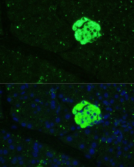 SFRP5 Antibody in Immunohistochemistry (Paraffin) (IHC (P))