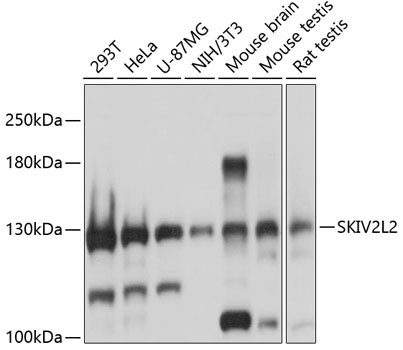 SKIV2L2 Antibody in Western Blot (WB)