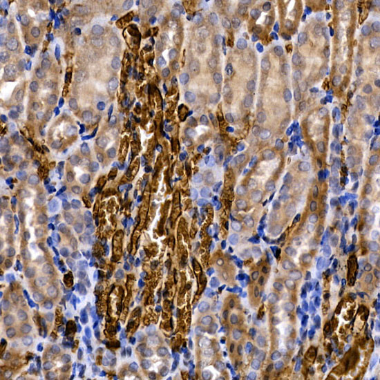 SLC14A1 Antibody in Immunohistochemistry (Paraffin) (IHC (P))