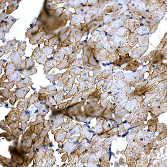 SLC14A1 Antibody in Immunohistochemistry (Paraffin) (IHC (P))