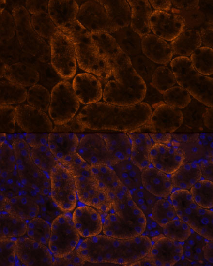 SLC14A1 Antibody in Immunohistochemistry (Paraffin) (IHC (P))