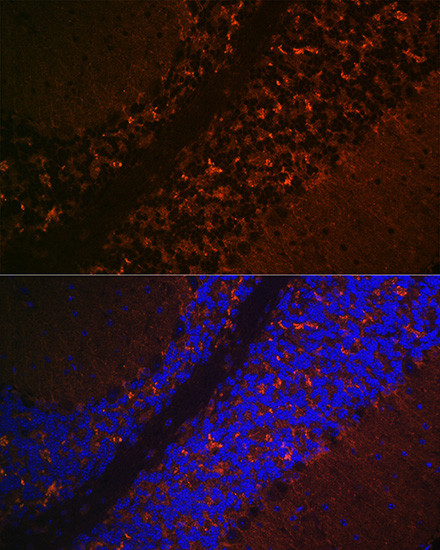 VGLUT2 Antibody in Immunohistochemistry (Paraffin) (IHC (P))