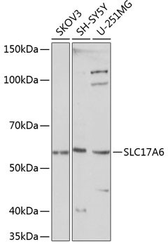 VGLUT2 Antibody in Western Blot (WB)