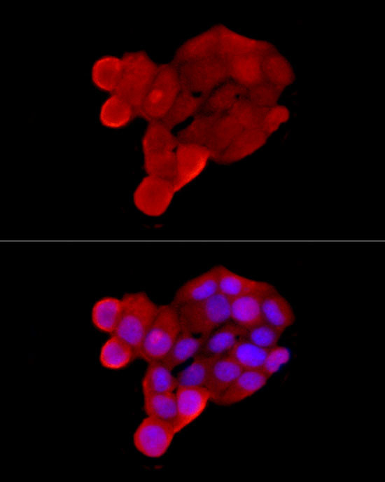 SLC22A5 Antibody in Immunocytochemistry (ICC/IF)