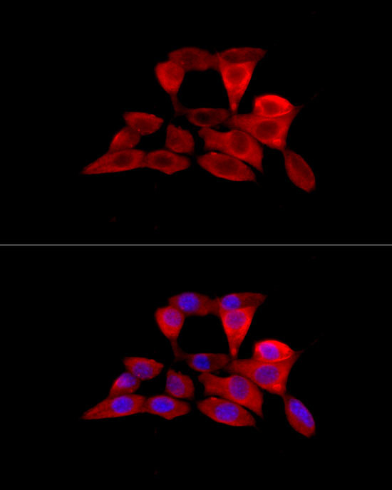 SLC22A5 Antibody in Immunocytochemistry (ICC/IF)