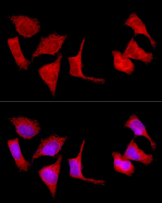 SLC27A1 Antibody in Immunocytochemistry (ICC/IF)