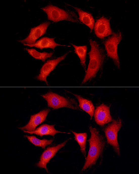 SLC27A1 Antibody in Immunocytochemistry (ICC/IF)