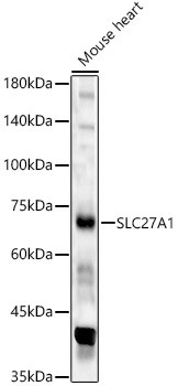 SLC27A1 Antibody in Western Blot (WB)