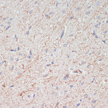 Dopamine Transporter Antibody in Immunohistochemistry (Paraffin) (IHC (P))