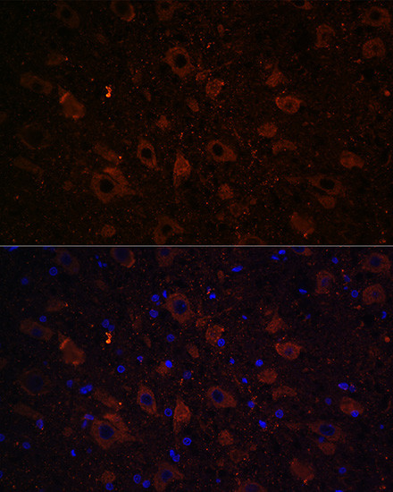 Dopamine Transporter Antibody in Immunohistochemistry (Paraffin) (IHC (P))