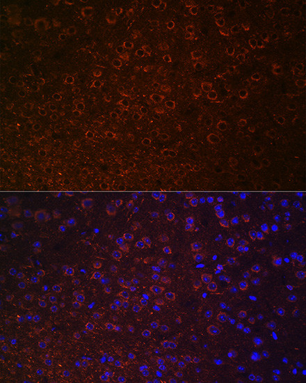 Dopamine Transporter Antibody in Immunohistochemistry (Paraffin) (IHC (P))