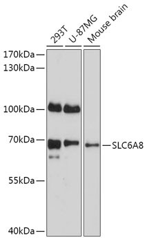 SLC6A8 Antibody in Western Blot (WB)