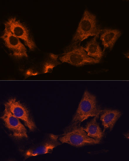 SMAP1 Antibody in Immunocytochemistry (ICC/IF)