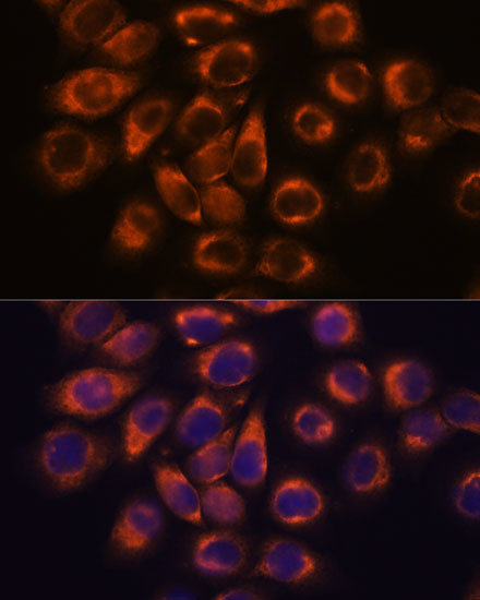 SMAP1 Antibody in Immunocytochemistry (ICC/IF)