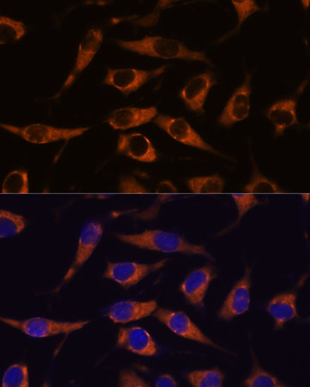 SMAP1 Antibody in Immunocytochemistry (ICC/IF)