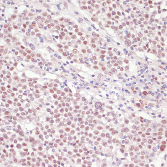 SNRNP70 Antibody in Immunohistochemistry (Paraffin) (IHC (P))