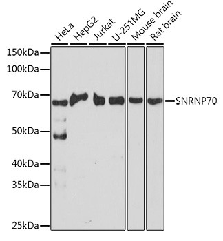 SNRNP70 Antibody in Western Blot (WB)