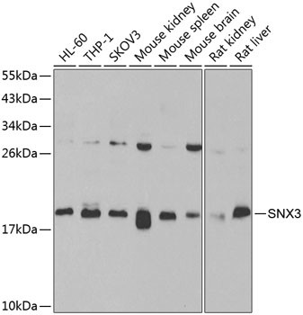 SNX3 Antibody in Western Blot (WB)