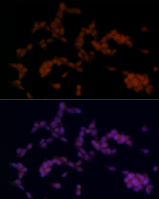 SOX11 Antibody in Immunocytochemistry (ICC/IF)