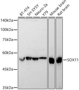 SOX11 Antibody in Western Blot (WB)