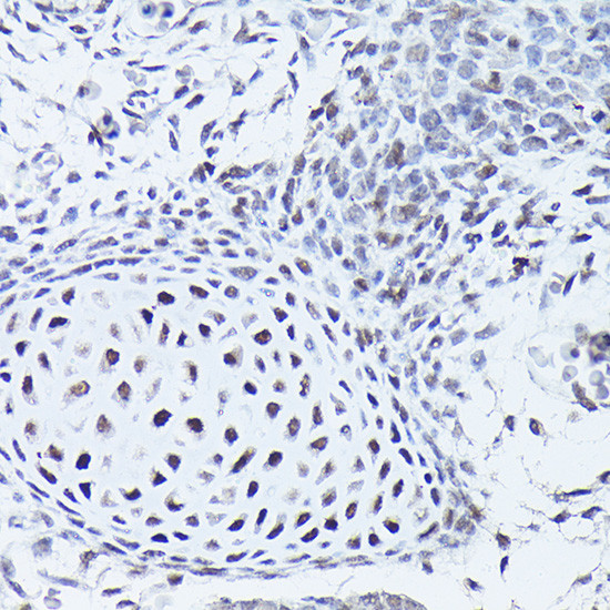 SOX5 Antibody in Immunohistochemistry (Paraffin) (IHC (P))