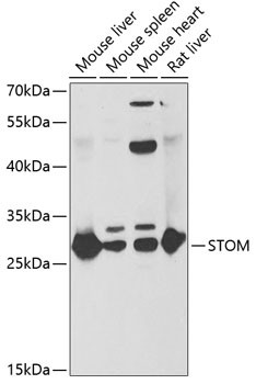 STOM Antibody in Western Blot (WB)