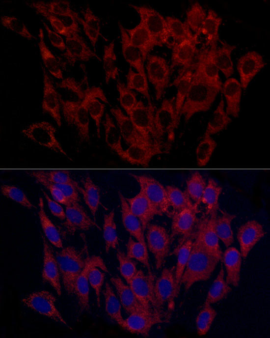 SURF4 Antibody in Immunocytochemistry (ICC/IF)